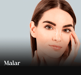 Malar