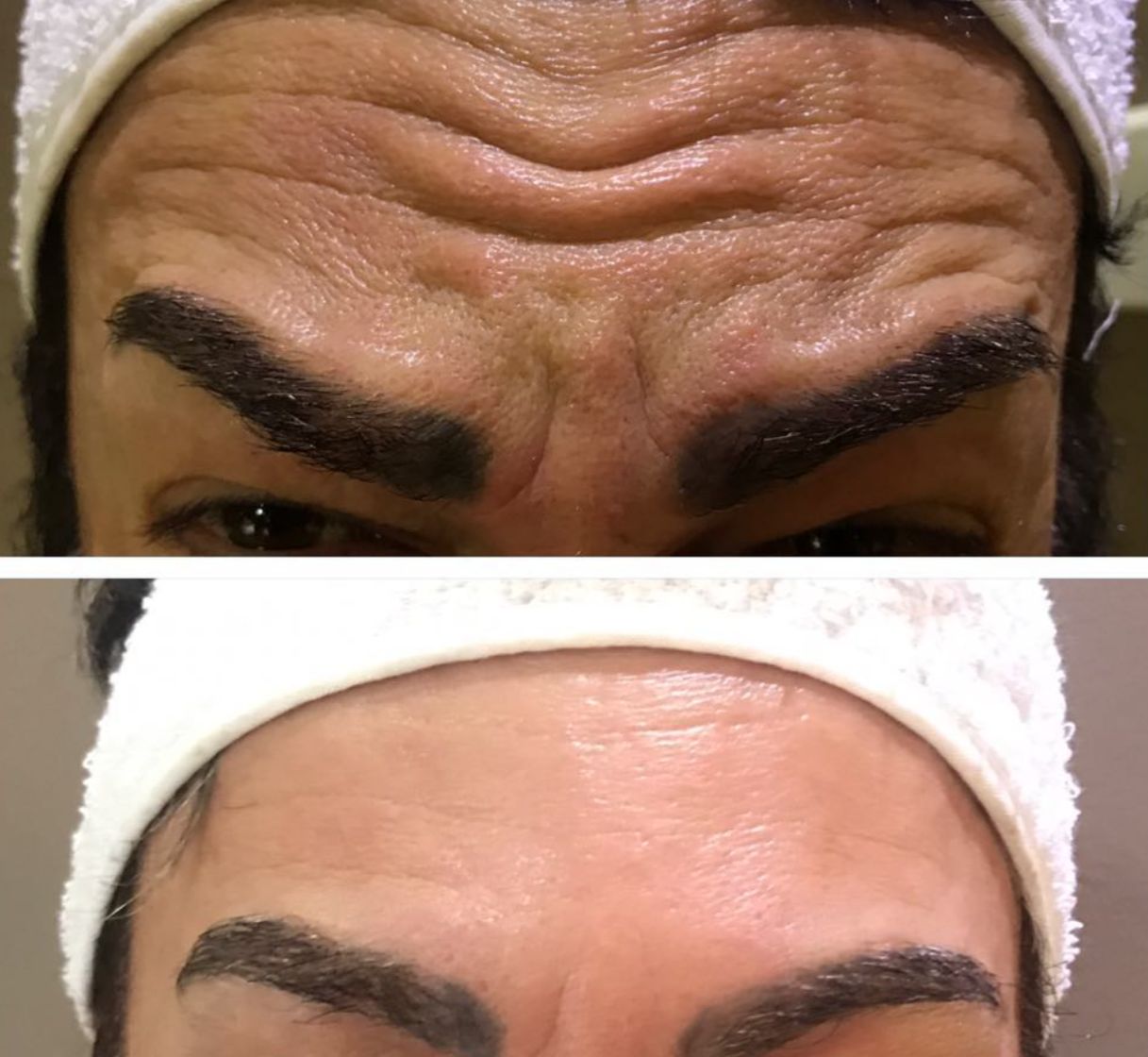 Antes e depois — resultado 2