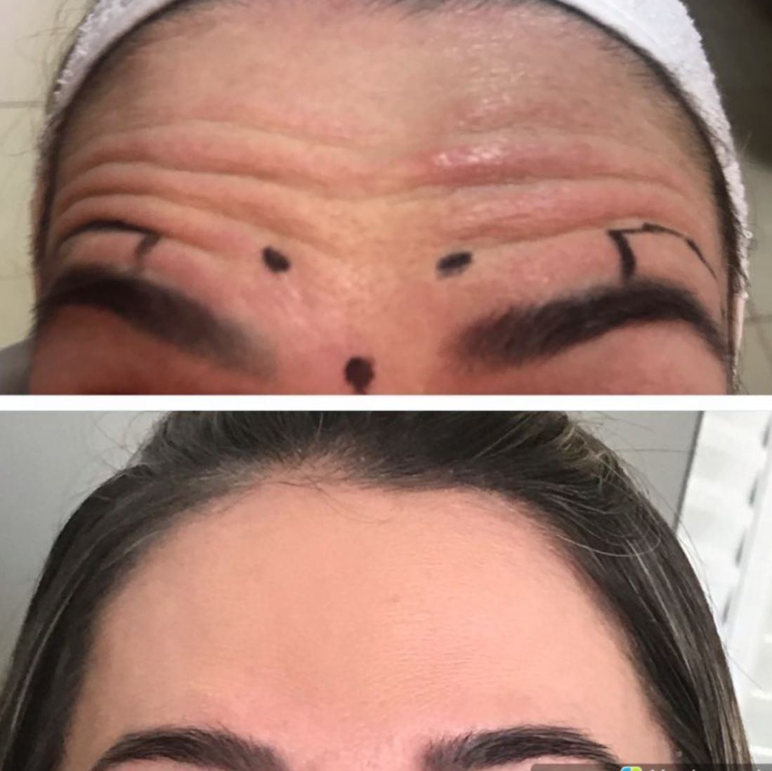 Antes e depois — resultado 3